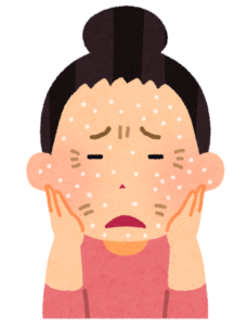 肌が乾燥して粉をふいている人のイラスト